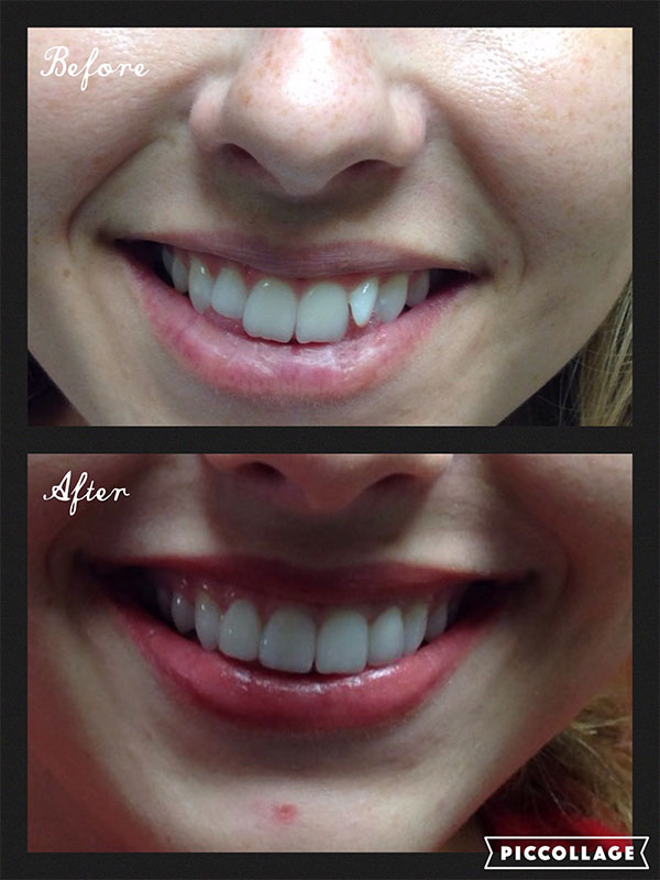BO MACDONALD DDS DENTISTRY BO MACDONALD DDS DENTISTRY