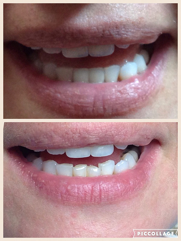 BO MACDONALD DDS DENTISTRY BO MACDONALD DDS DENTISTRY