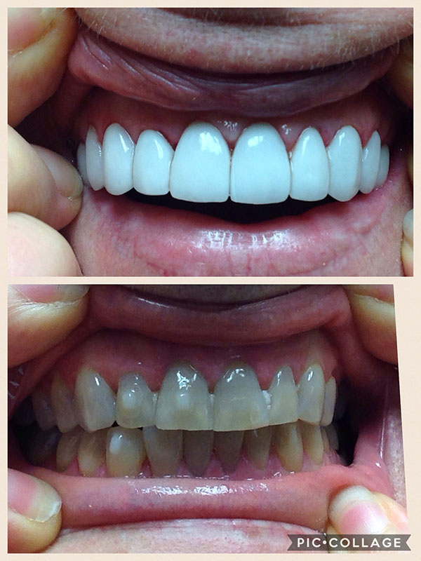 BO MACDONALD DDS DENTISTRY BO MACDONALD DDS DENTISTRY