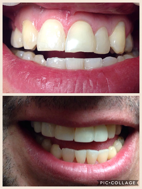 BO MACDONALD DDS DENTISTRY BO MACDONALD DDS DENTISTRY