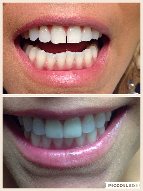 BO MACDONALD DDS DENTISTRY BO MACDONALD DDS DENTISTRY