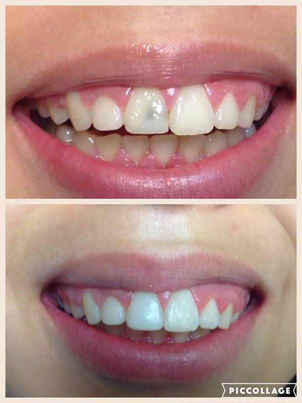 BO MACDONALD DDS DENTISTRY BO MACDONALD DDS DENTISTRY