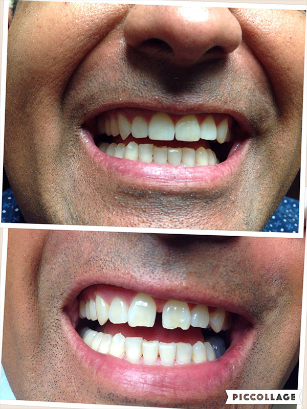 BO MACDONALD DDS DENTISTRY BO MACDONALD DDS DENTISTRY