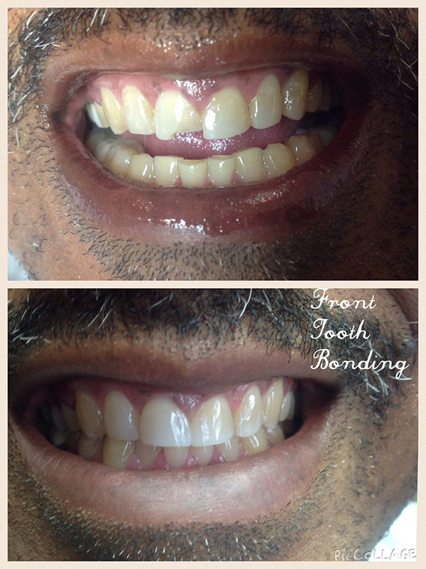 BO MACDONALD DDS DENTISTRY BO MACDONALD DDS DENTISTRY
