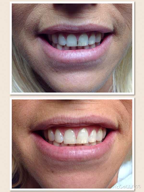 BO MACDONALD DDS DENTISTRY BO MACDONALD DDS DENTISTRY