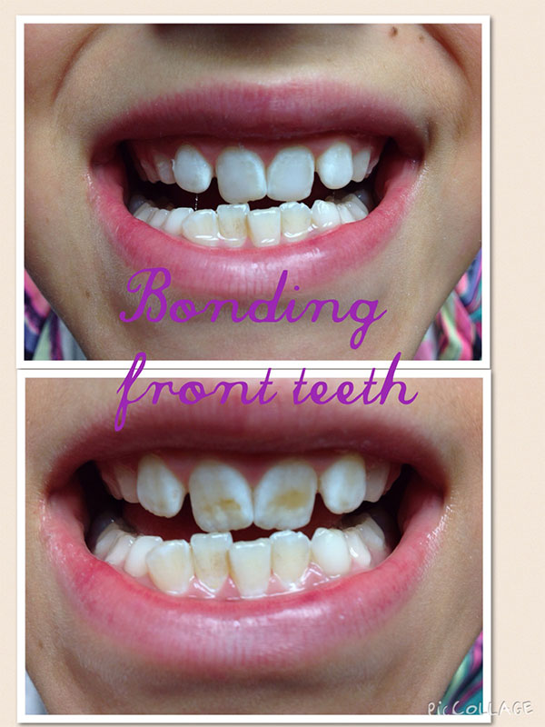 BO MACDONALD DDS DENTISTRY BO MACDONALD DDS DENTISTRY